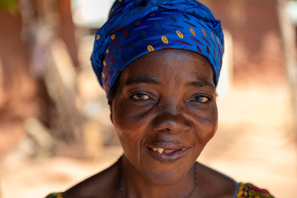 Adjoa smiling after cleft surgery