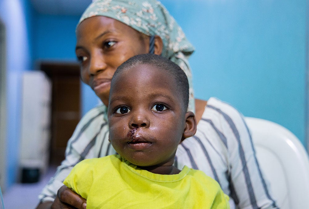 Opeyemi sitting on Deborah's lap after cleft surgery