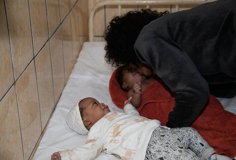 Audrey kissing Lloyd and Floyd before their cleft surgeries