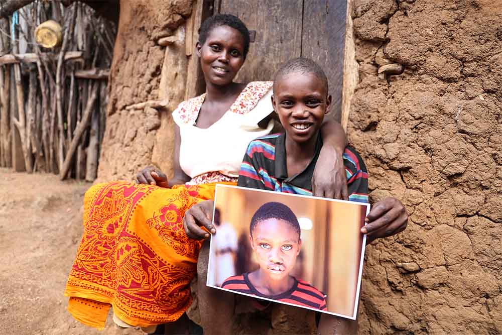 Ayubu smiling with his mother and holding a photo of himself after cleft surgery