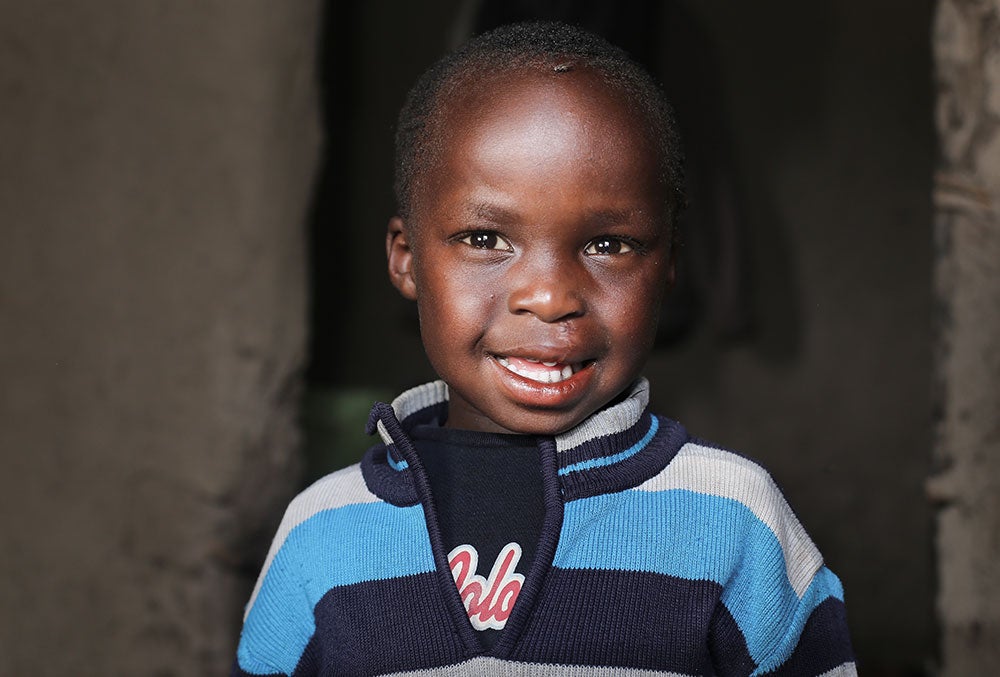 Benjamin smiling after cleft surgery