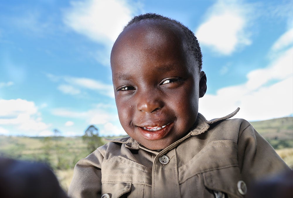 Benjamin smiling after cleft surgery