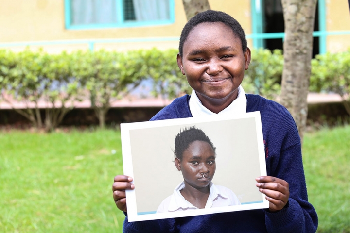Damaris smiling and holding a photo of herself before cleft surgery