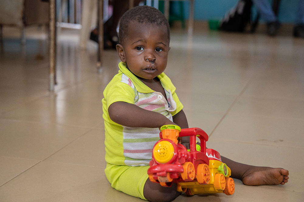Immaculata playing with a toy train after cleft surgery