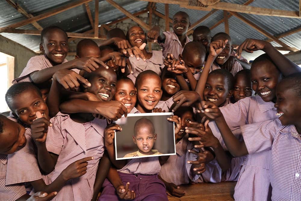 Johana souriant avec ses camarades de classe et tenant une photo d'elle avant l'opération d'une fente