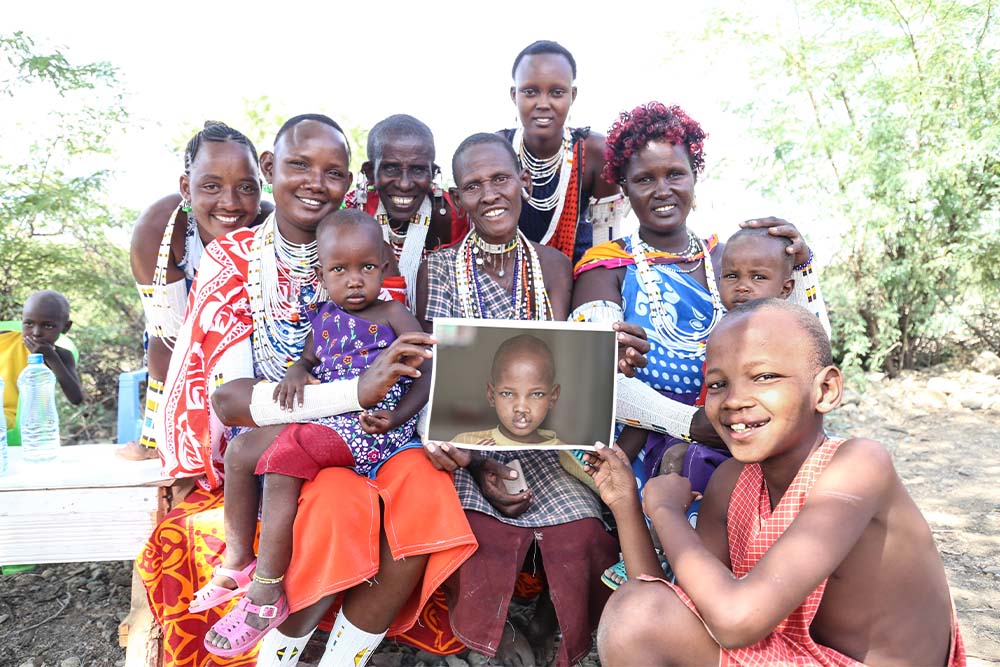 Johana sourit avec sa famille après une opération à une fente