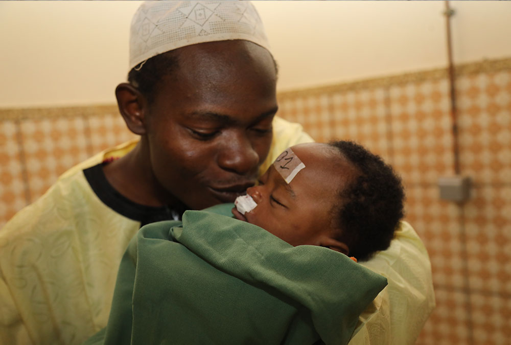 Mouhamed's father kissing him after cleft surgery