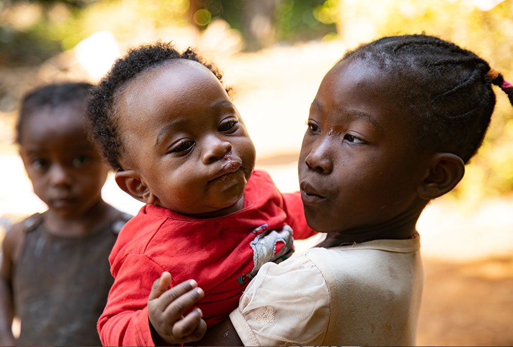 Mouhamed held by his sisters after cleft surgery