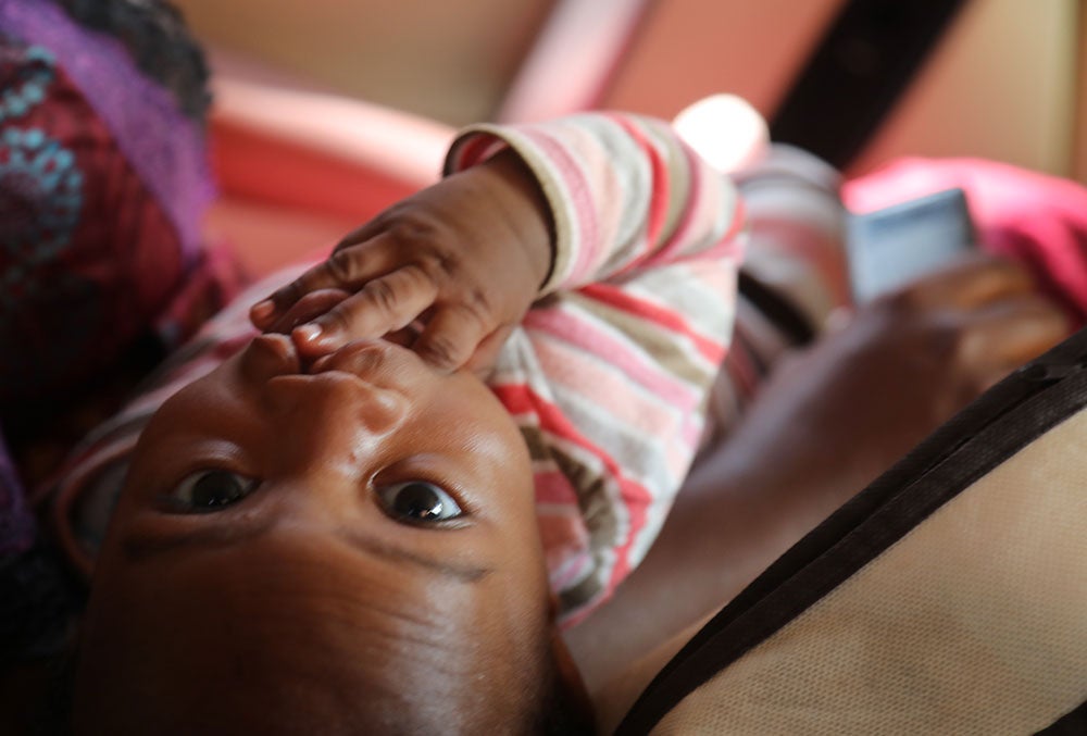 Mouhamed looking up before his cleft surgery