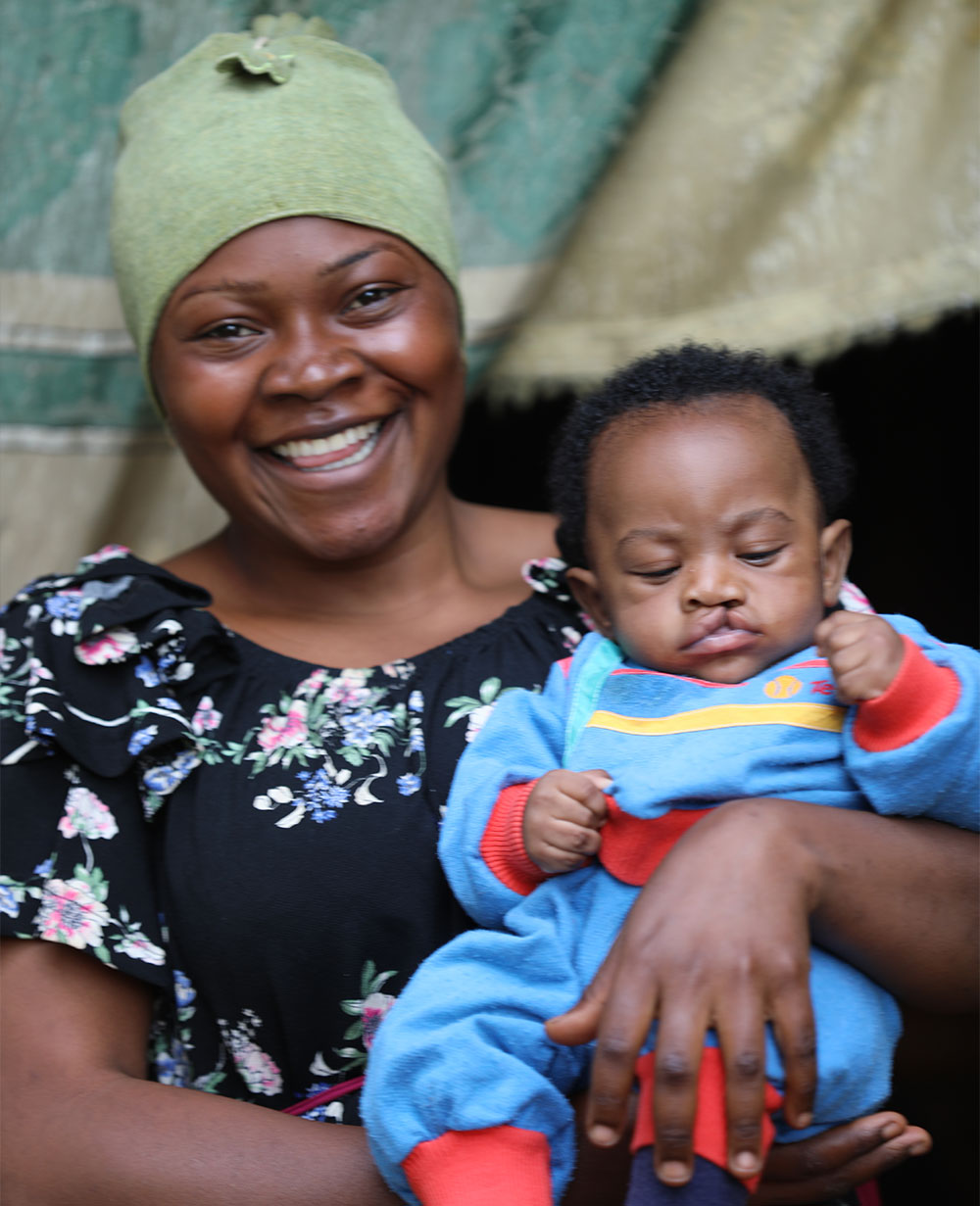 Mouhamed with his mother Rafiatou before cleft surgery