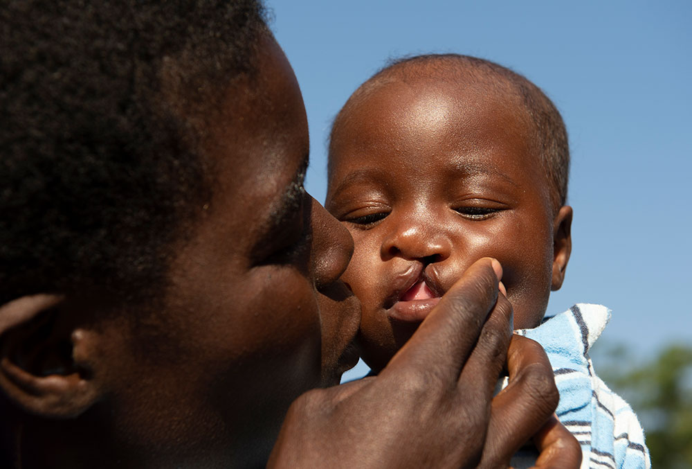 Nyasha's mother Rosemary kissing her before her cleft surgery