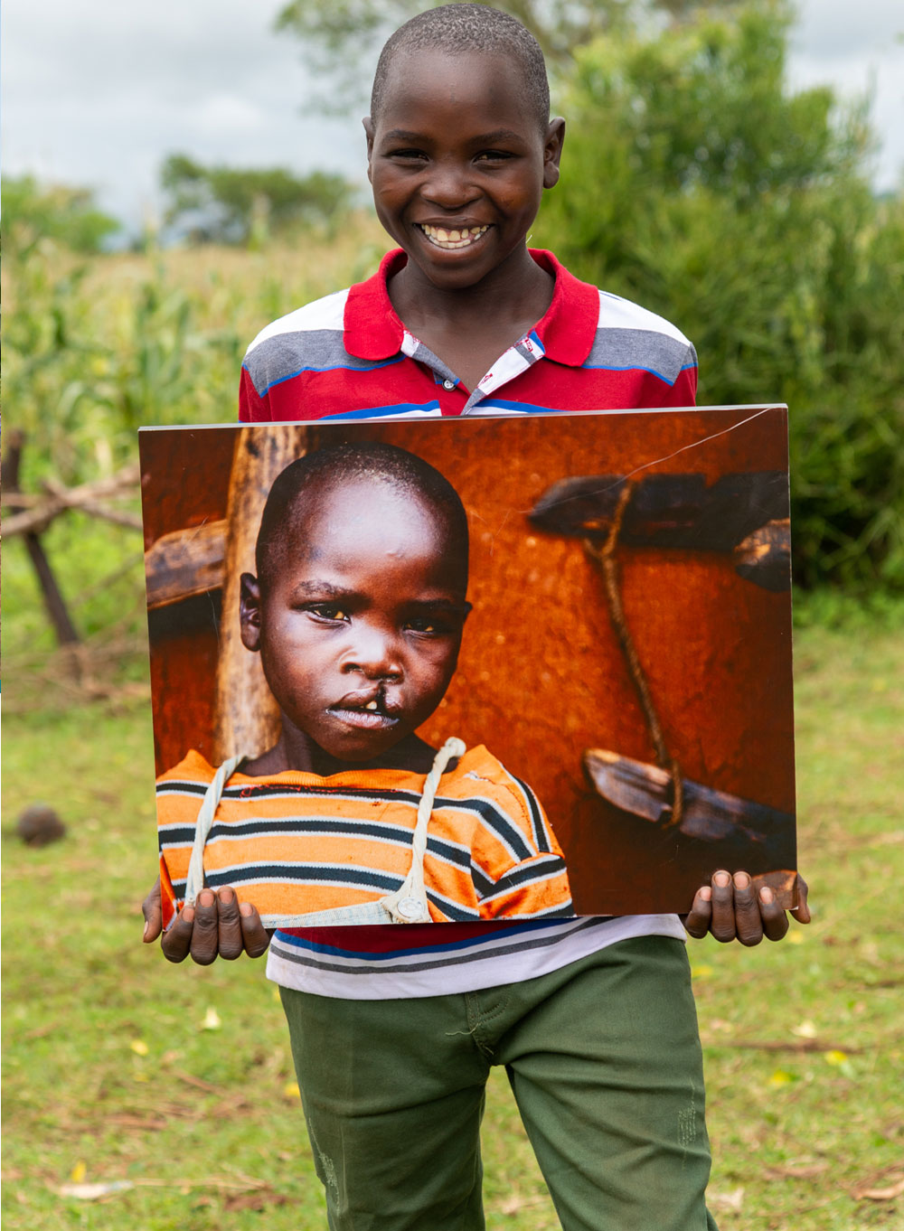Osawa smiling and holding a photo of himself before cleft surgery