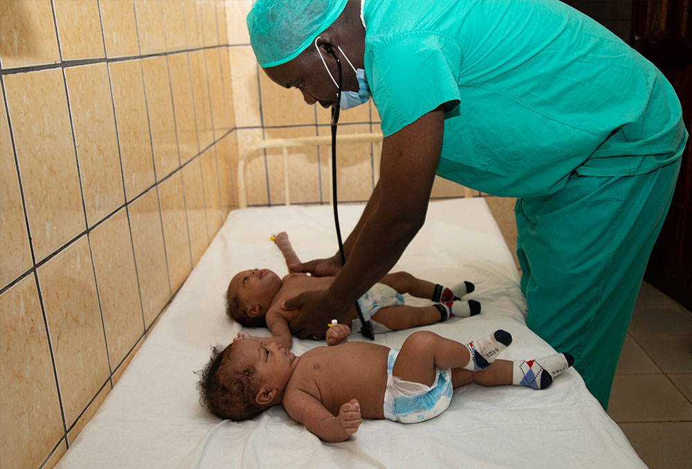 Professor Mouafo Tambo examining Lloyd and Floyd before their cleft surgeries