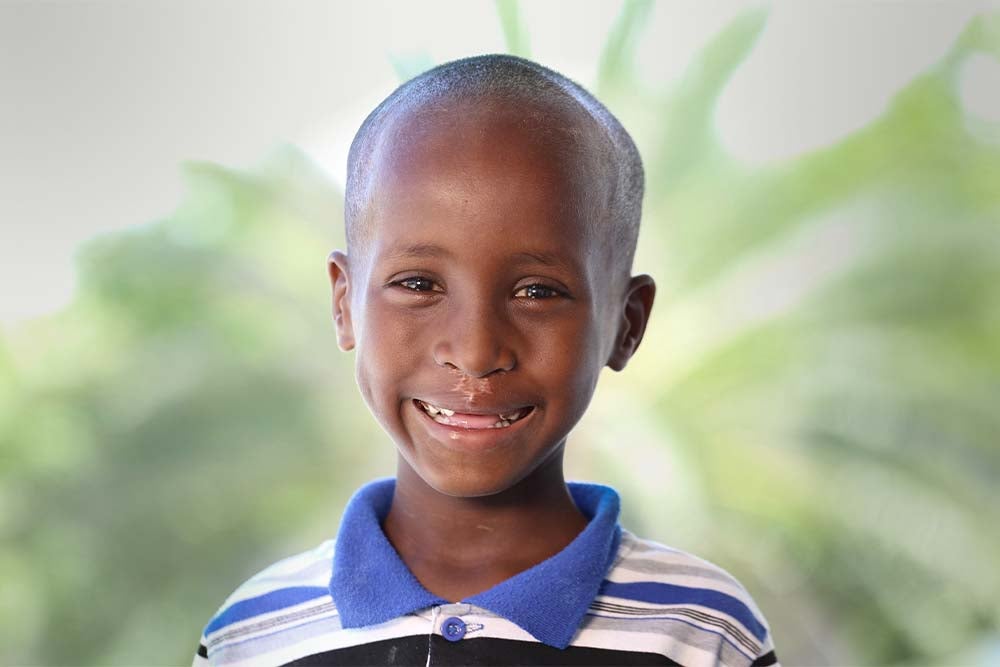 Shariif smiling after cleft surgery