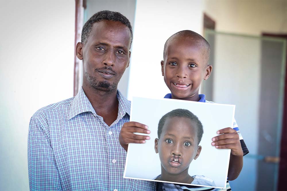 Shariif smiling with his father Mohammed and holding a picture of himself before cleft surgery