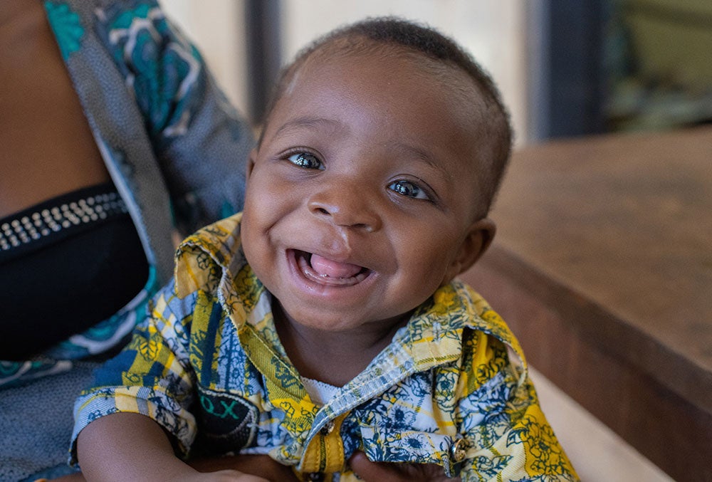 Annointed smiling after cleft surgery