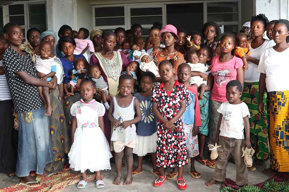 Cleft-affected patients before surgery