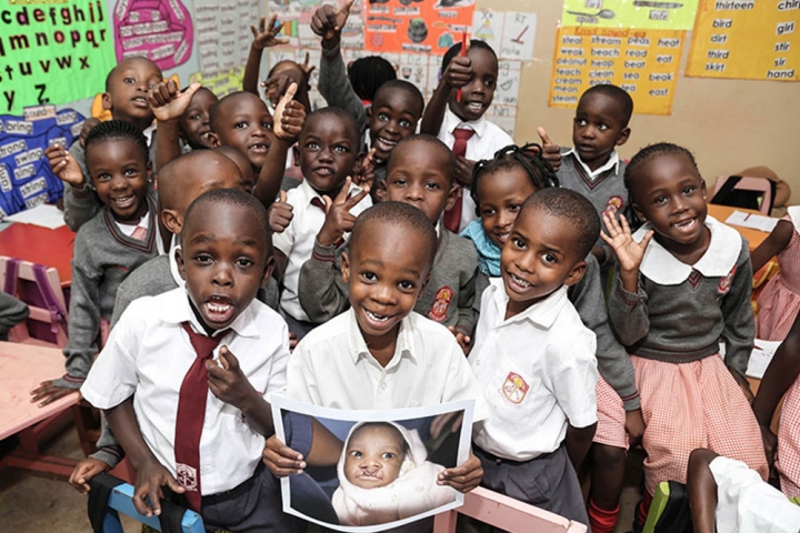 Livingstone smiling with his friends and holding a picture of himself before cleft surgery