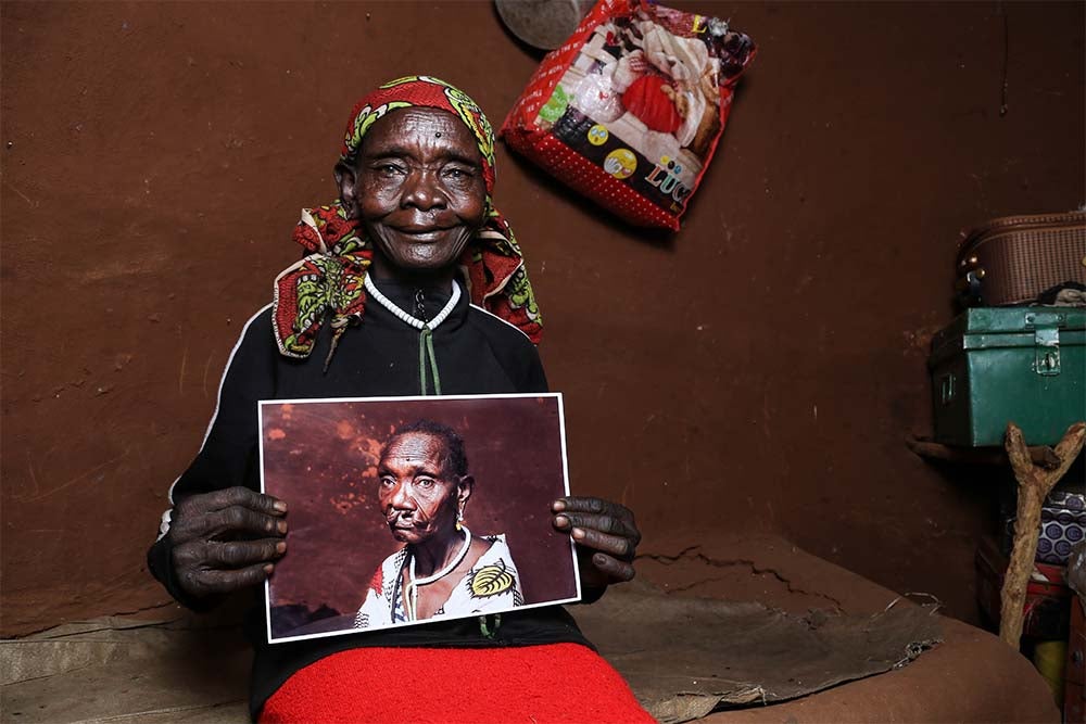 Maria smiling and holding a picture of herself from before cleft surgery