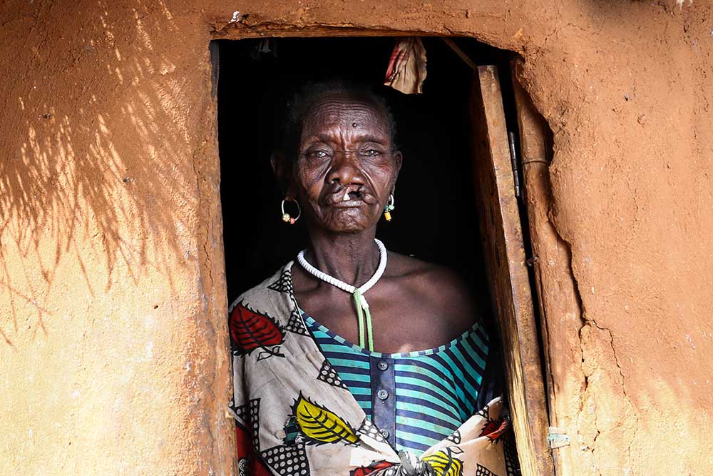 Maria standing before cleft surgery