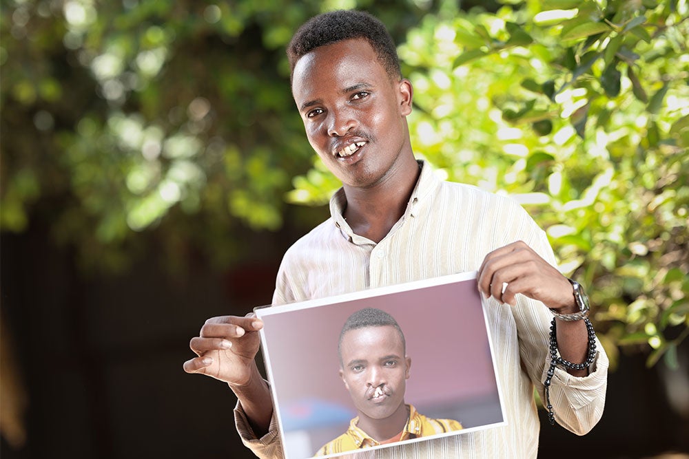 Ali smiling and holding a picture of himself before cleft surgery