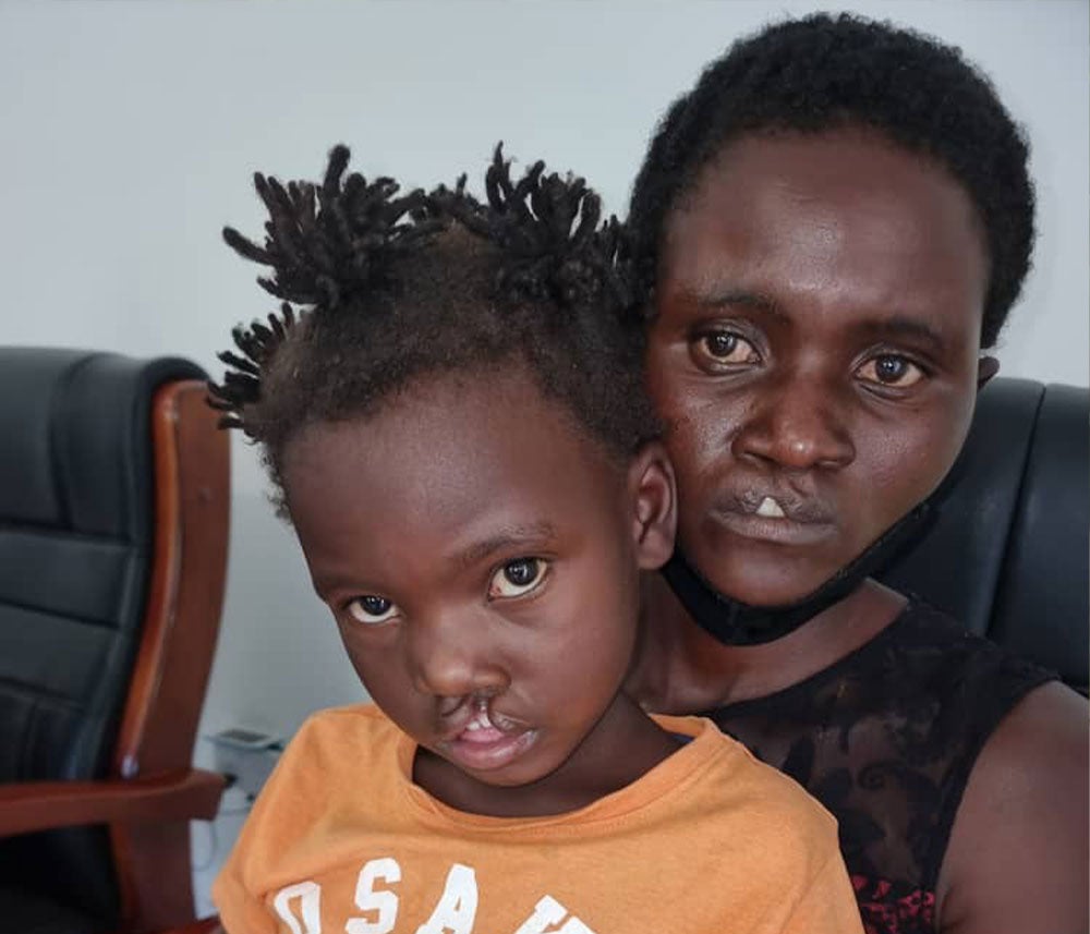 Siriza and Janerose sitting in the hospital just before their cleft surgeries