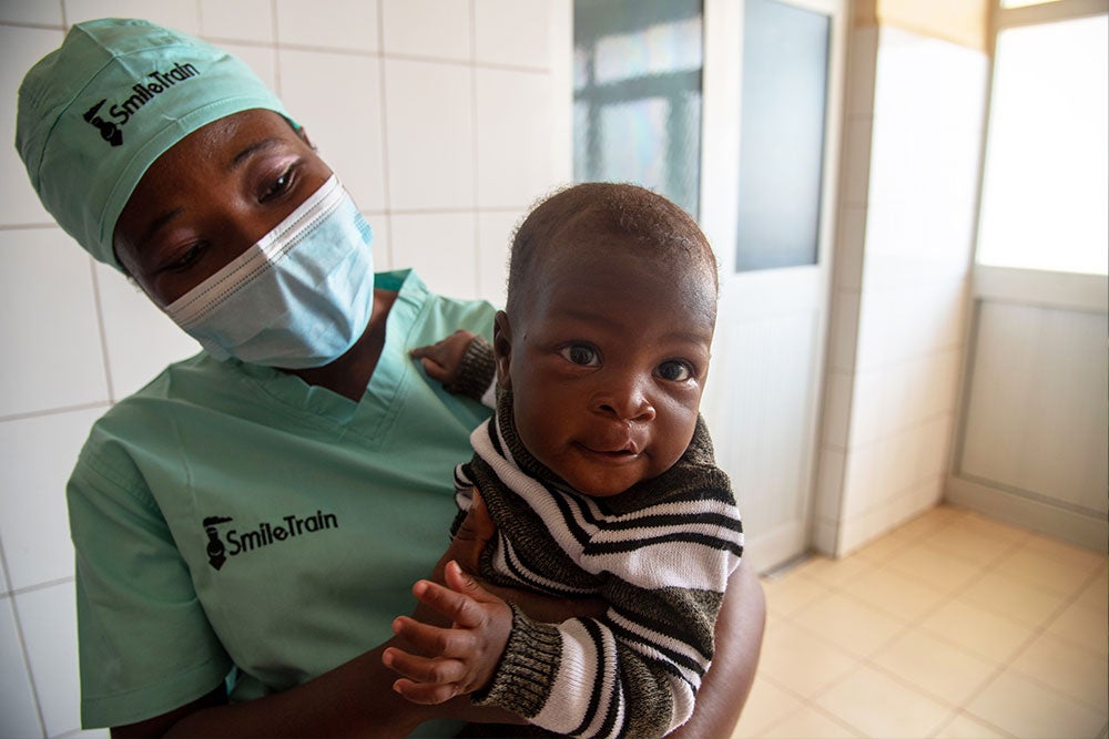 This baby is smiling now thanks to Dr. Sanni and Smile Train donors!