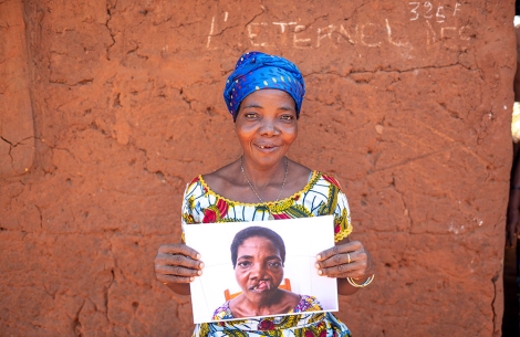 Adjoa smiling and holding a photo of herself before cleft surgery