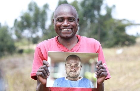 Wesley smiling and holding a photo of himself before cleft surgery