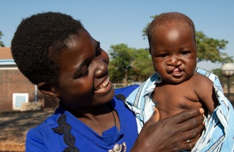 Rosemary smiling and holding Nyasha before cleft surgery