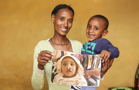 Yohanes smiling with his mother Atsede and holding a photo of himself before cleft surgery