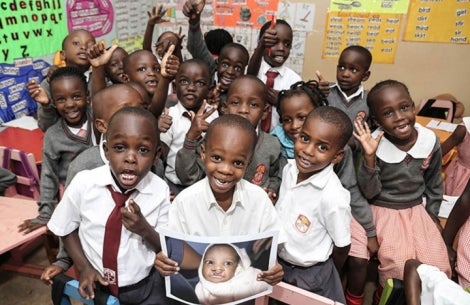 Livingstone smiling with his friends and holding a picture of himself before cleft surgery