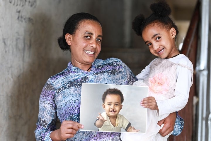 Marsillas and her mother Zinash smiling and holding a picture of herself before cleft surgery