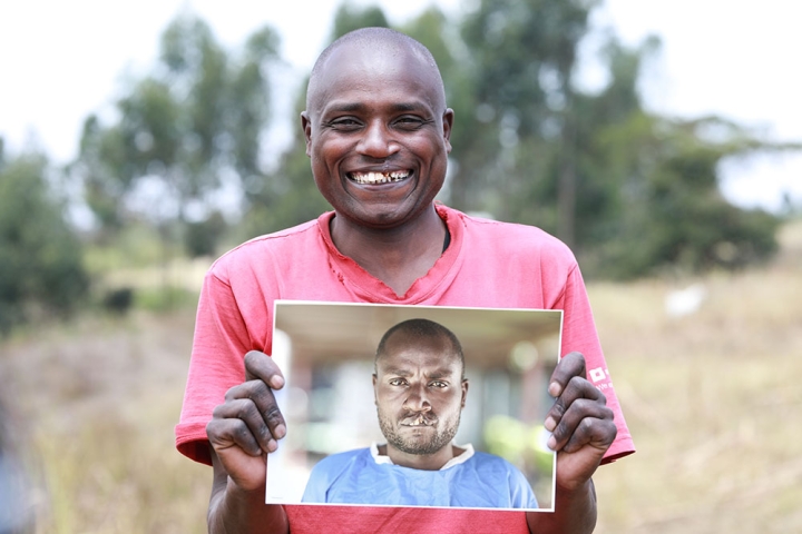 Wesley smiling and holding a photo of himself before cleft surgery