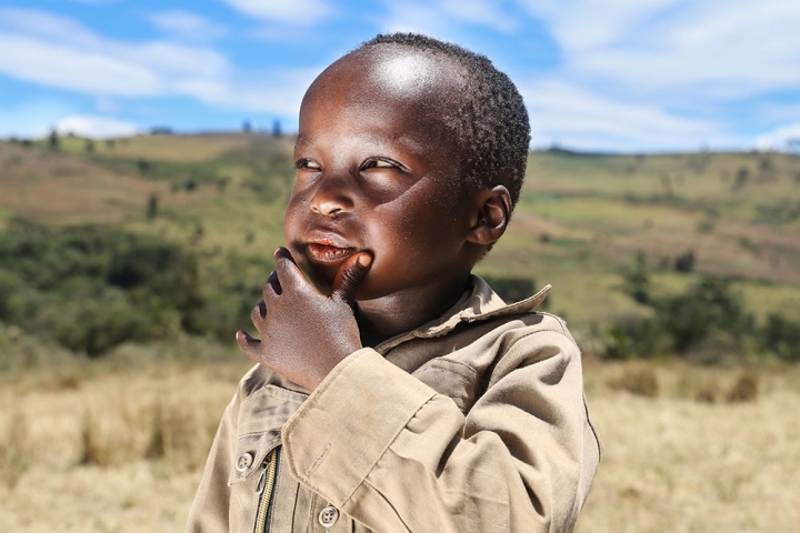 Benjamin thinking outside with his hand on his chin after cleft surgery