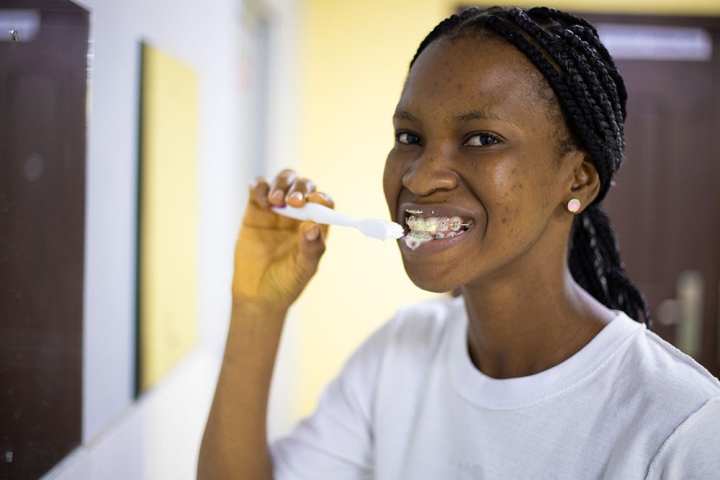 cleft patient brushes teeth 