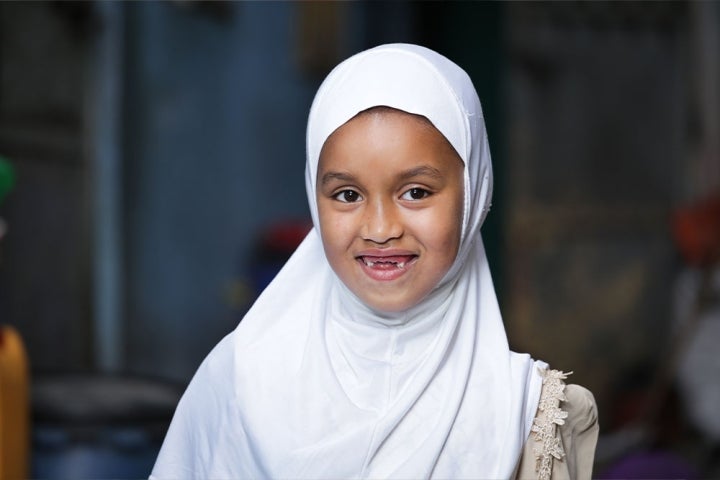 Sabira smiling after cleft surgery