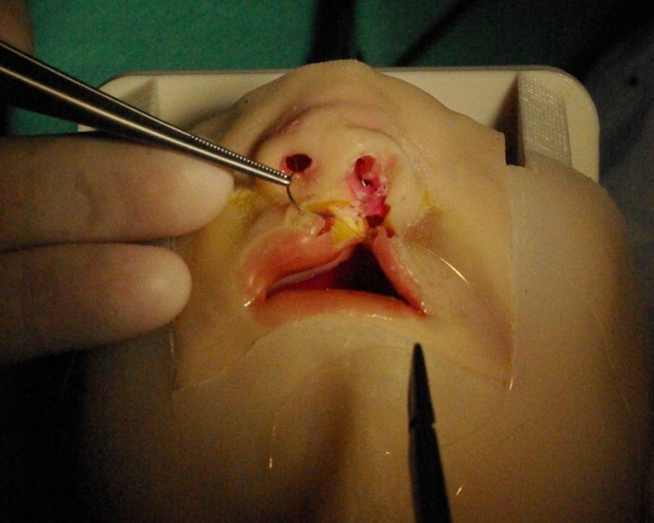simulare cleft surgery