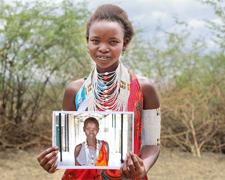 Woman from Kenya after cleft surgery