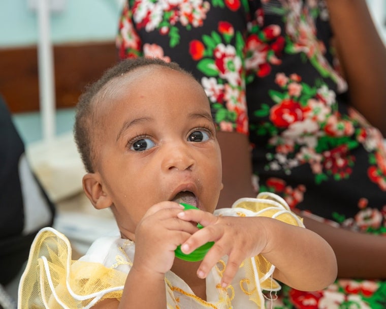 Cleft-affected Smile Train nutrition patient