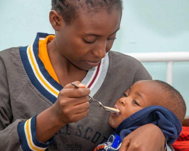 Mother feeding cleft-affected baby