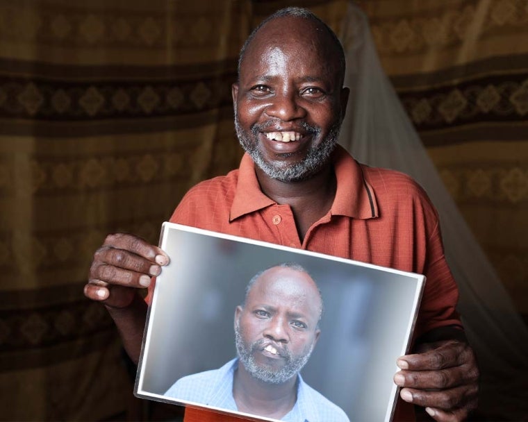 Adan smiling and holding a photo of himself before cleft surgery