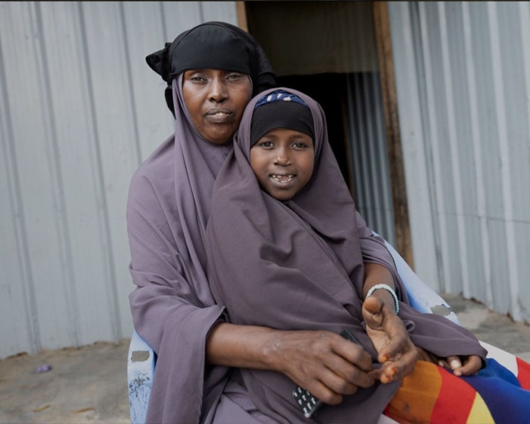 Fadumo and Nasro smling after cleft surgery