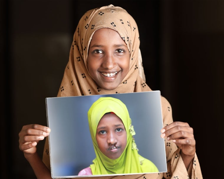 Maryan smiling and holding a picture of herself before cleft surgery