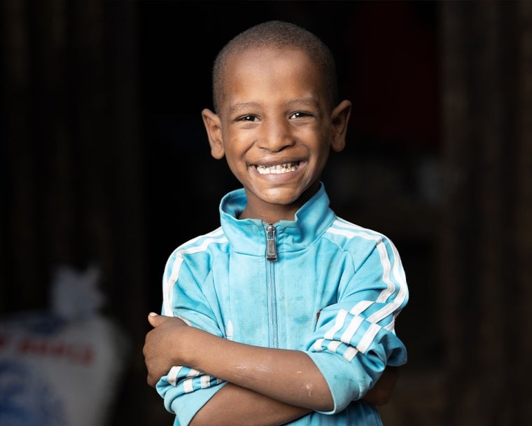 Omar smiling after cleft surgery