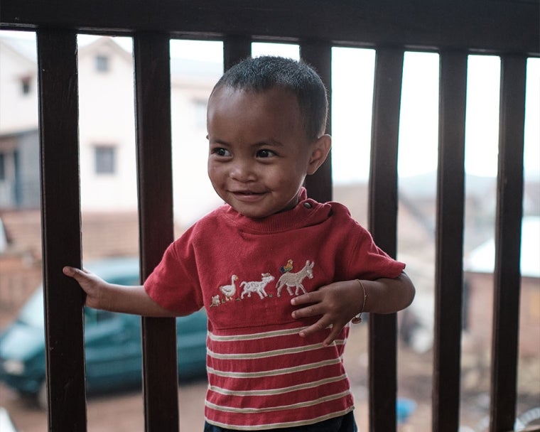 Eden smiling after cleft surgery