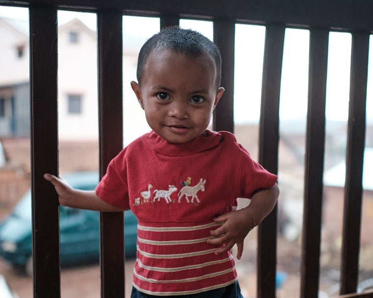 Eden smiling after cleft surgery